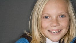 Ein Junge mit langen blonden Haare zeigt seine Zahnspange im Mund.
