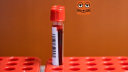 Zwei Blutproben stehen in einem Reagenzglasständer