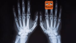 Röntgen-Bild