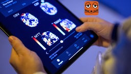 Eine Radiologin betrachtet in einer App auf einem Tablet Gehirnbilder eines Patienten
