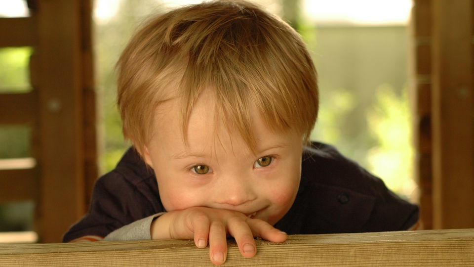 Junge mit Down-Syndrom schaut über Holzbalken.