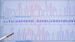 Ein Computerbildschirm zeigt eine DNA-Sequenzierung.