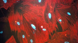 Zellen der glatten Muskulatur unter dem Mikroskop.