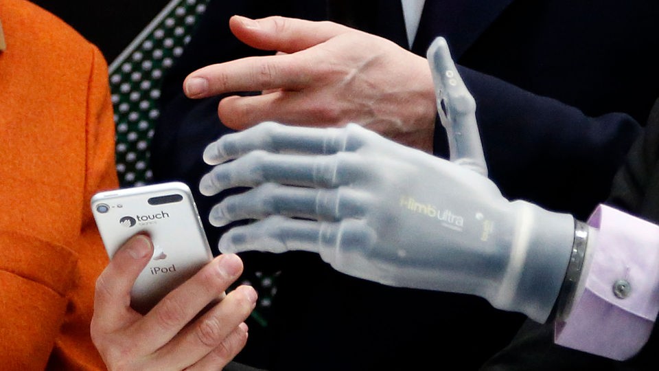 Bionische Handprothese neben einer normalen Hand.