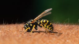 Wespe sitzt auf menschlicher Haut.